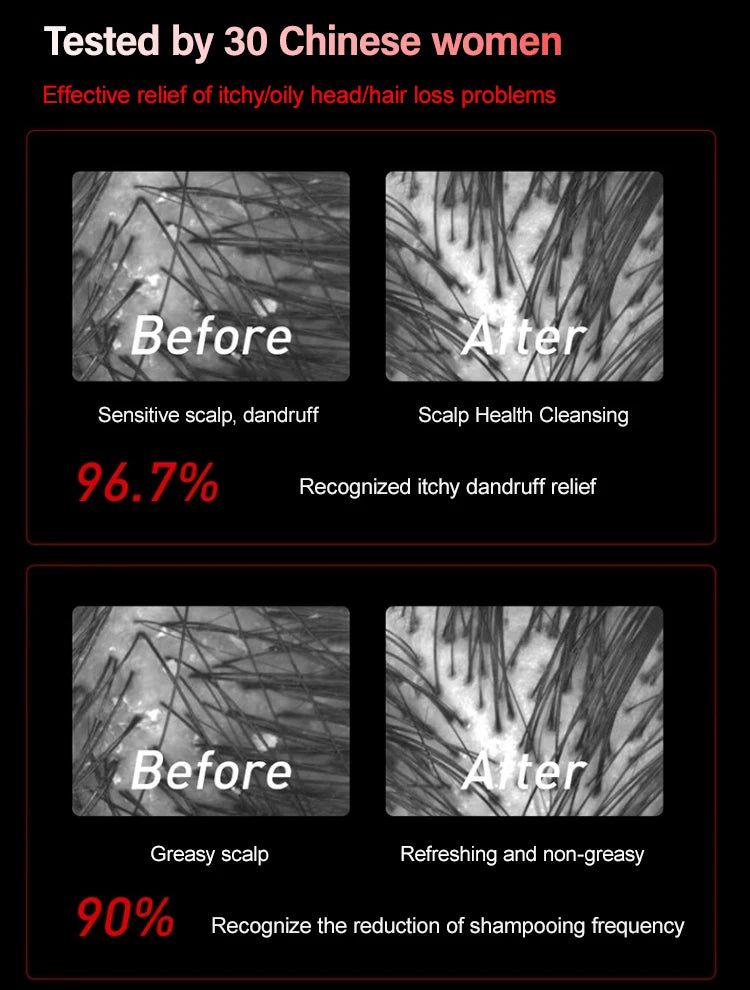 Electric Massage Comb Vibration Red Light Therapy Hair Growth Massage Scalp Brush Anti Hair Loss Liquid Oil Applicator Hair Care