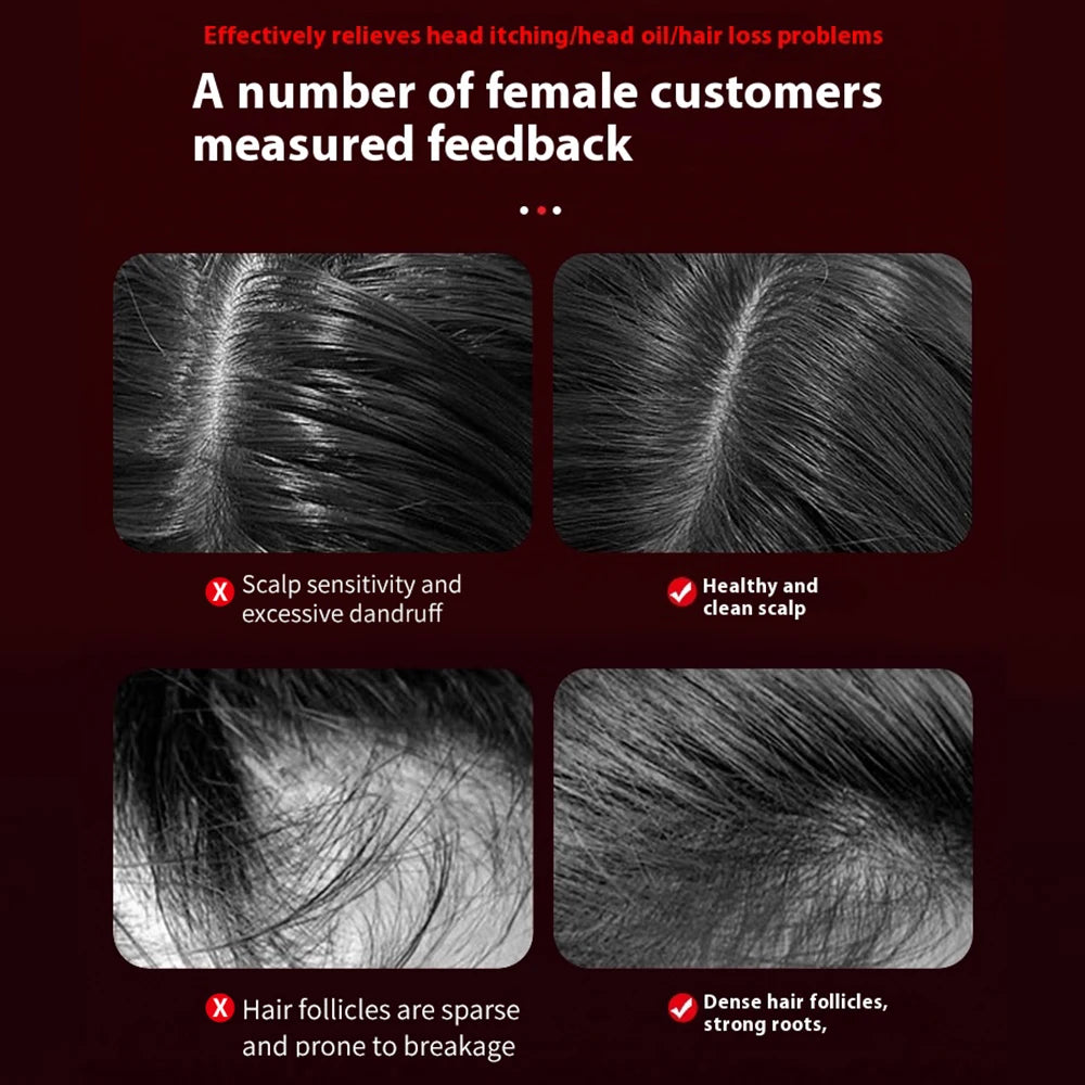 Red Light Vibration Head Massage Comb Electric Massage Comb Oil Applicator Nourishing Scalp Brush Hair Growth Anti Hair Loss
